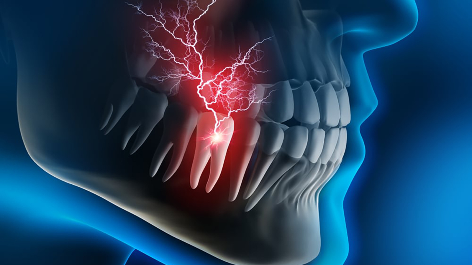 Heavy dental pain - 3D illustration