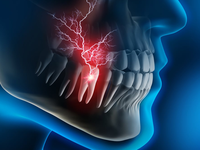 Heavy dental pain - 3D illustration