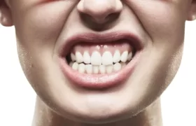 Bruxism